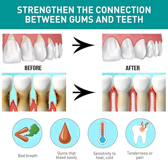 🦷 Eelhoe - Mouth Relief Spray (Original)