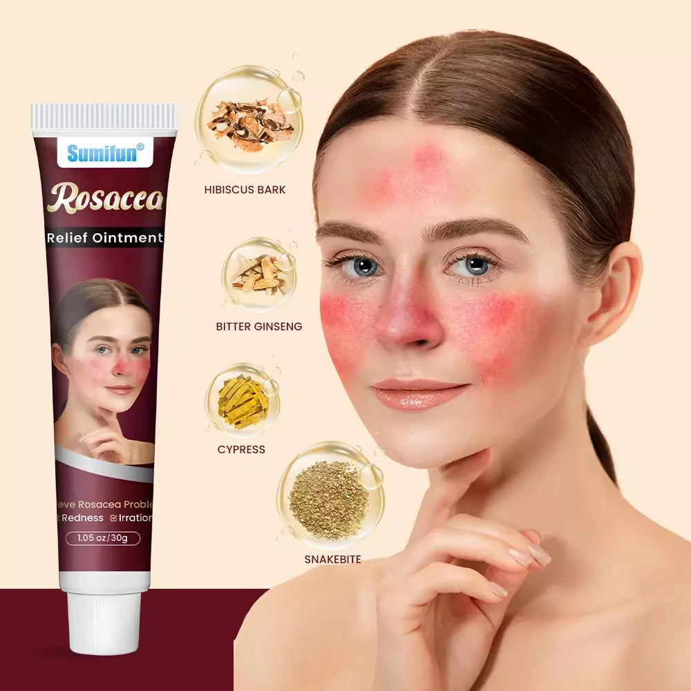 🌸 Sumifun – Rosacea Relief Ointment (Original) – 30g