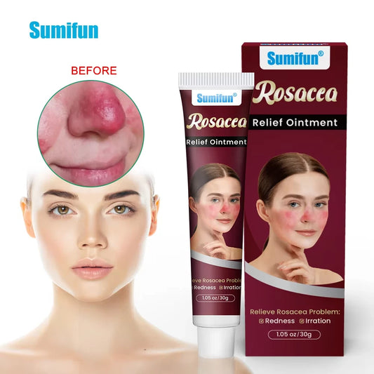 🌸 Sumifun – Rosacea Relief Ointment (Original) – 30g