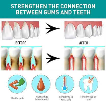 🦷 Eelhoe - Mouth Relief Spray (Original)
